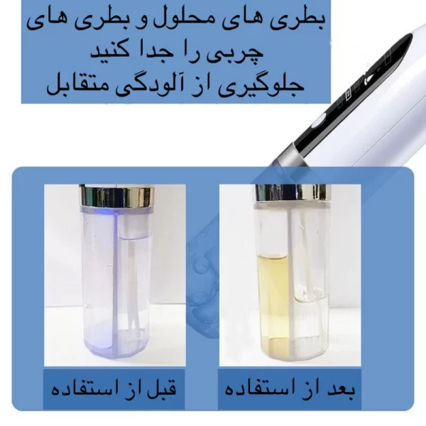 میکرودرم خانگی مدل Super Micro Bubble